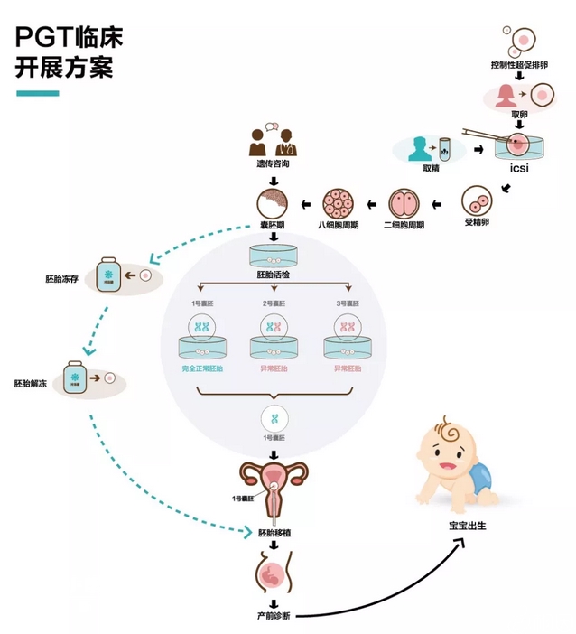 第三试管技术治疗地贫的方案