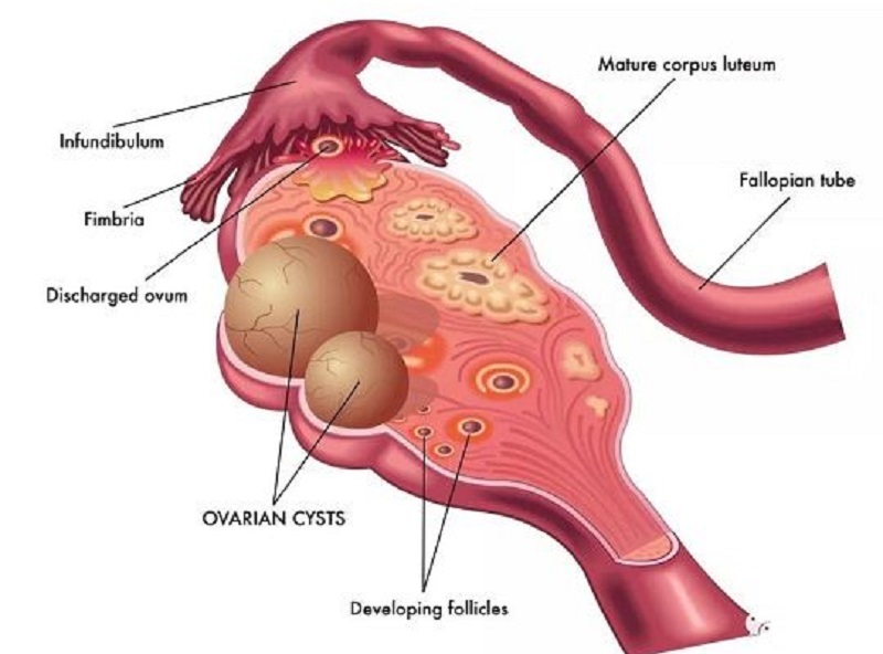 卵巢结构图