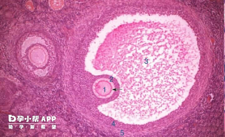 试管婴儿卵泡监测作用