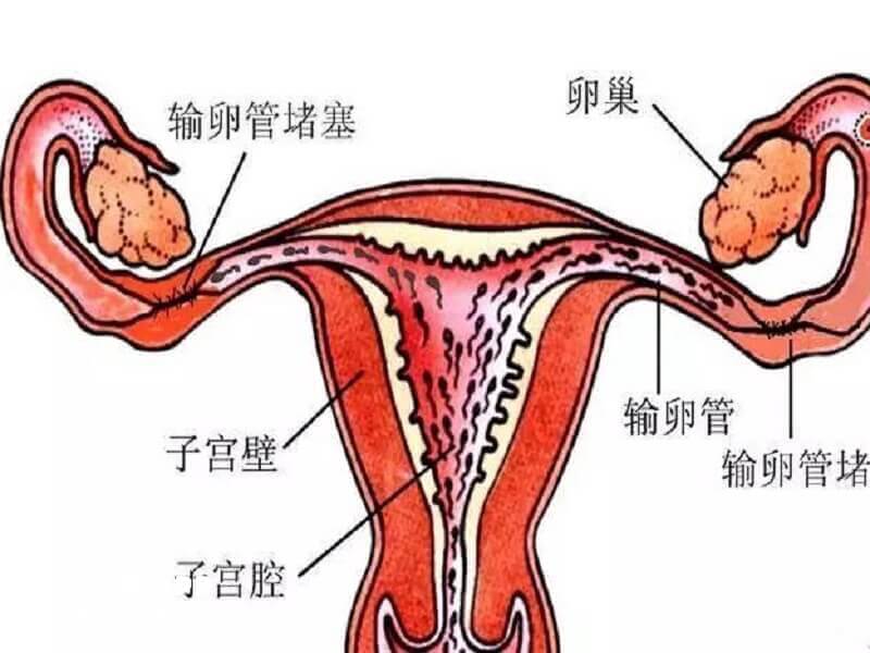 输卵管堵塞做试管年龄越大成功率越低