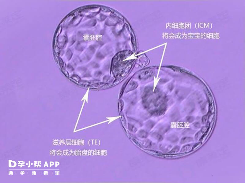 胚胎实验室按欧美标准建设