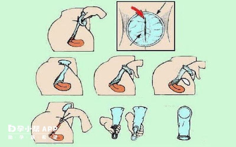 避孕膜的使用方法