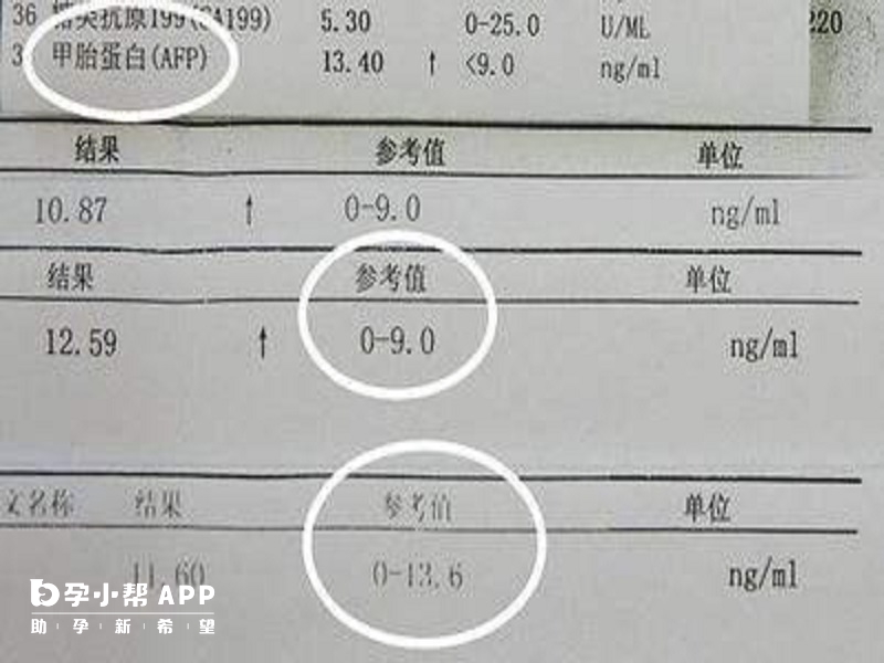 甲胎蛋白的正常值