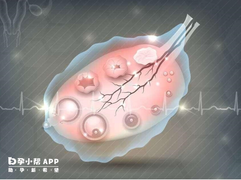 自然排卵后依然存在小卵泡