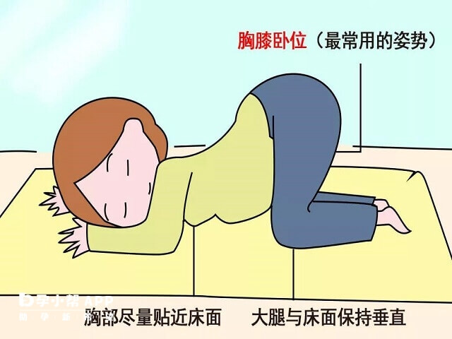 膝胸卧位正确姿势图