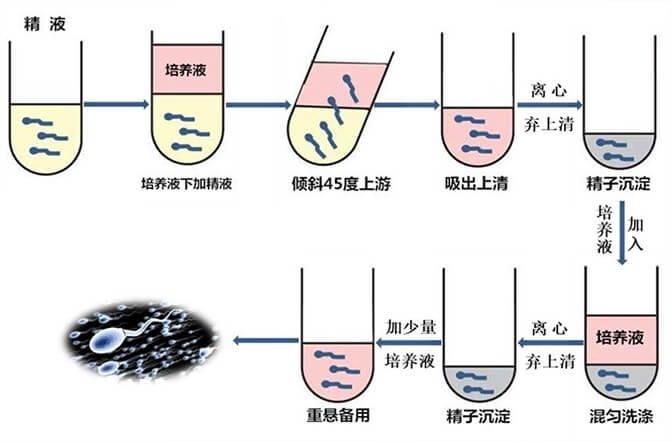 洗精的直接上游法