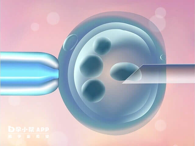 试管婴儿卵泡浆置换技术