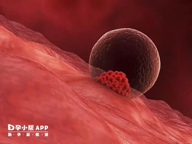 子宫腺肌症会影响受精卵着床