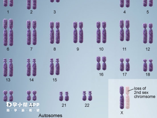 特纳氏综合征患者可以做第三代试管婴儿