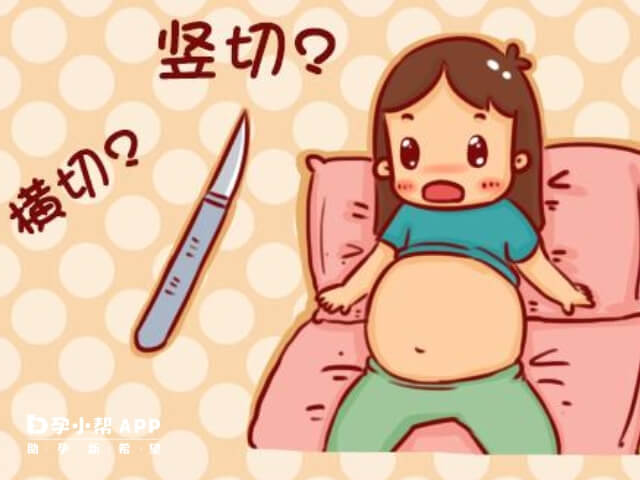 横剖对女性的身体以及胎盘有要求