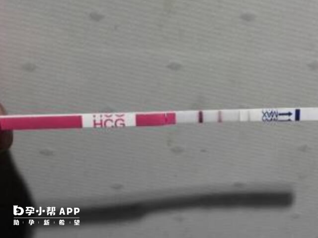 hcg也叫做人绒毛膜促性腺激素