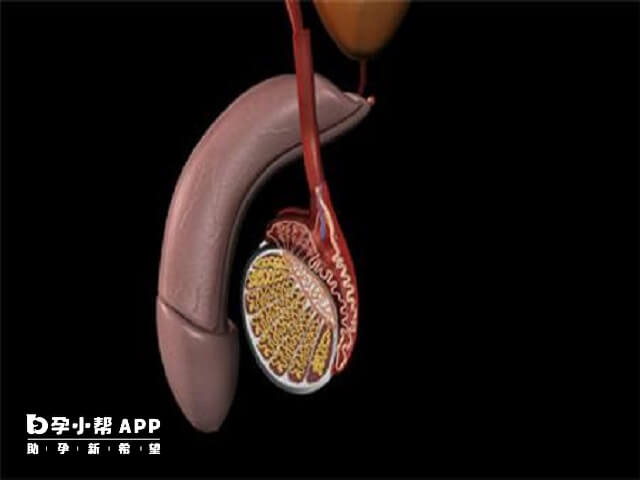 可以用睾丸穿刺取精的方式取出精子