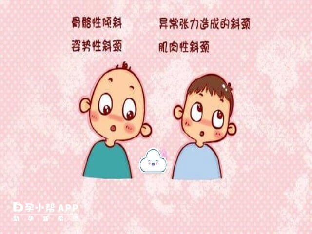 纠正婴儿歪头和斜颈的方法