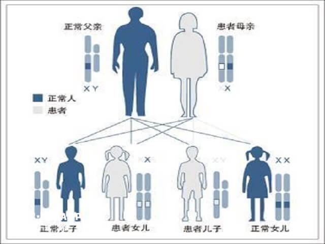 腋臭三代遗传规律