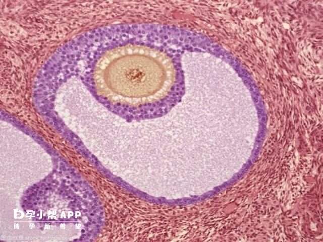 小卵泡受孕的孩子可能会出现缺陷