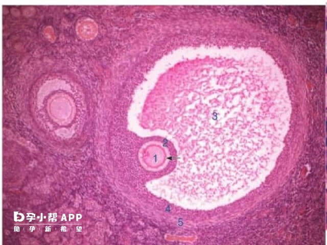 宫颈病变可能会导致试管怀孕后反复少量出血