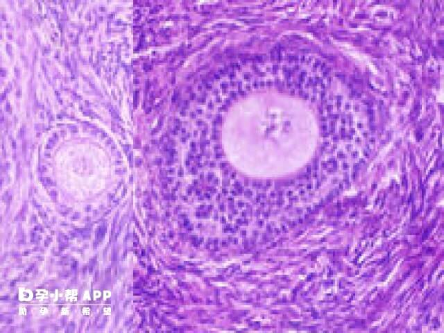 成熟卵泡塌陷可能是萎缩了
