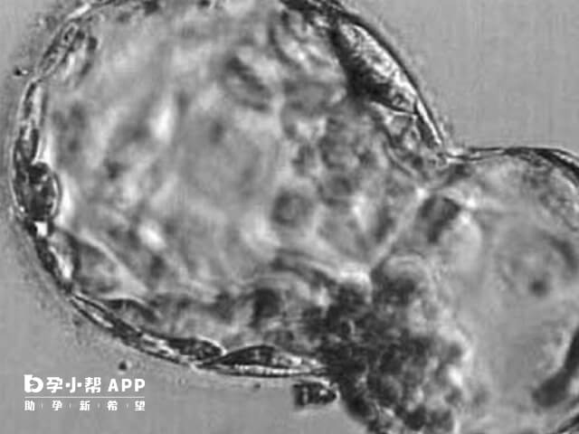 内膜7.5mm着床的几率会少一些