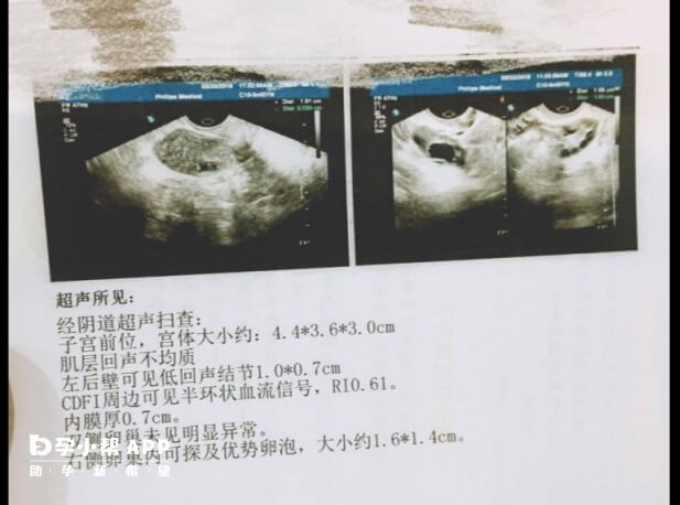 B超检查单