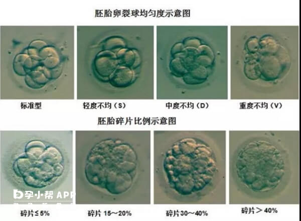 胚胎卵裂球碎片率