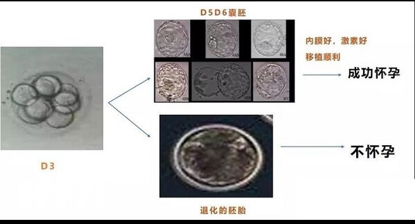 优胚和囊胚移植哪个好