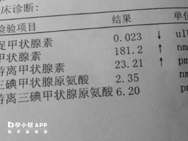 要看懂甲减的化验单很简单