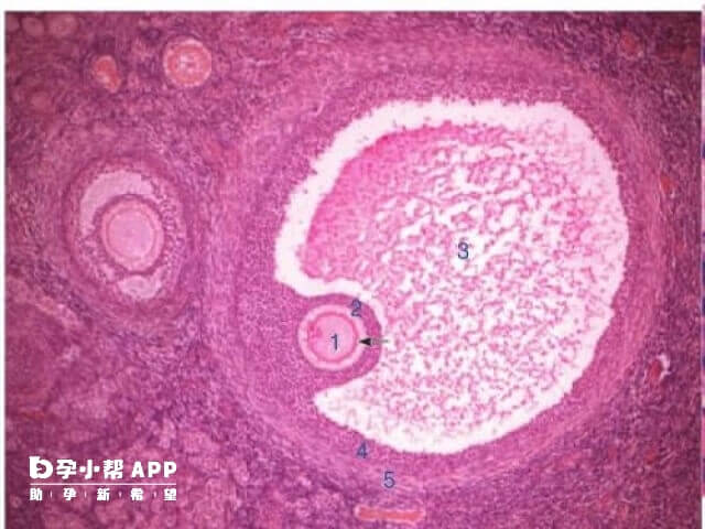 试管鲜胚移植失败和肥胖是没有关系的