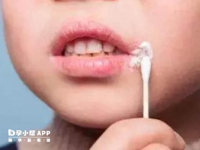 小孩子嘴唇周围红肿可能是上火