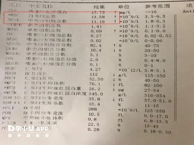 血常规24项能查出贫血