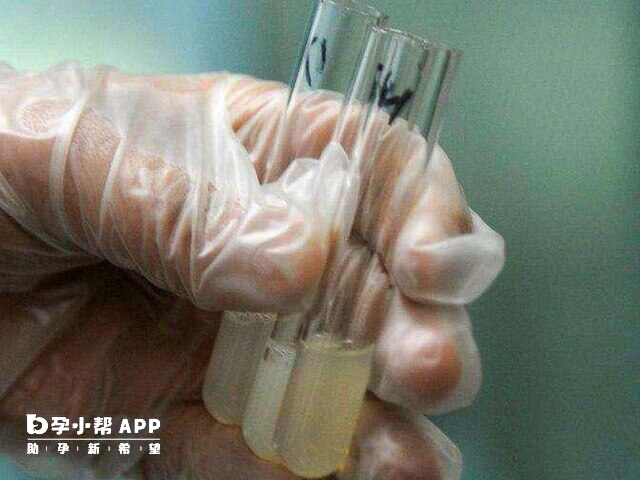 HIV洗精术能实现正常生育