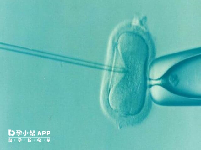 试管取卵手术中用的针有多粗与医生选择的管型有一定的区别