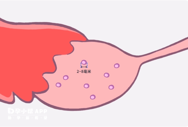 窦卵泡1-2mm的时候以被B超发现