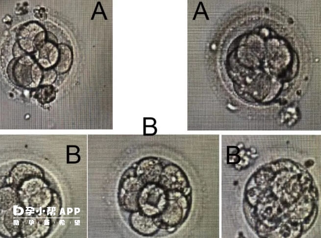 以ABCDE评价胚胎质量