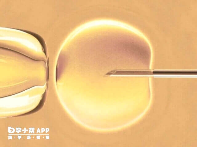 检查和手术条件限制会导致空卵泡