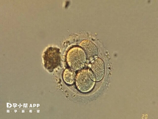 与4cc囊胚是否还有必要移植有关的因素