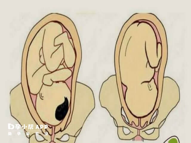 胎儿头位期间摸肚子下方比较硬