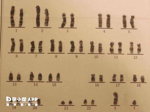 人体内已经是有23对染色体