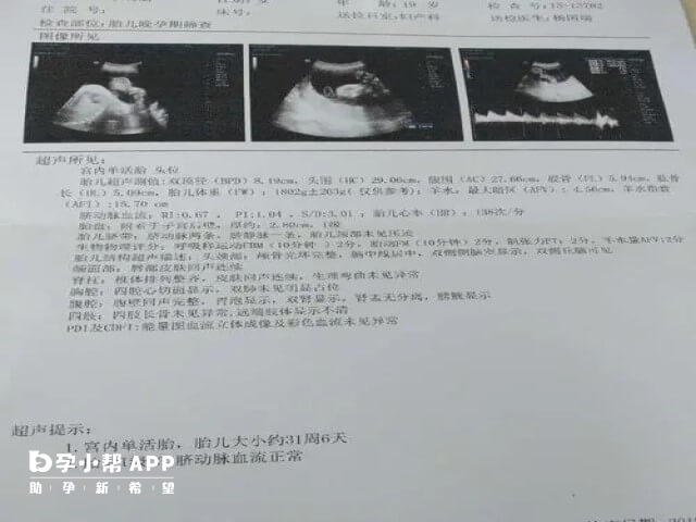 腿短与胎儿的性别没有关系