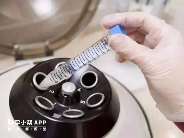 xy精子分离术的具体操作步骤