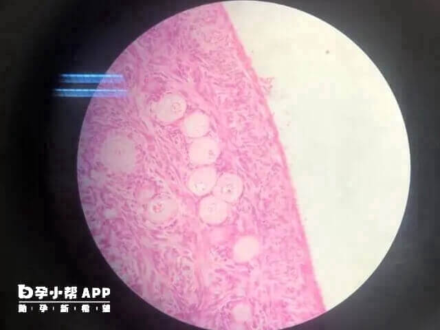 女性每个月只有一个成熟卵泡