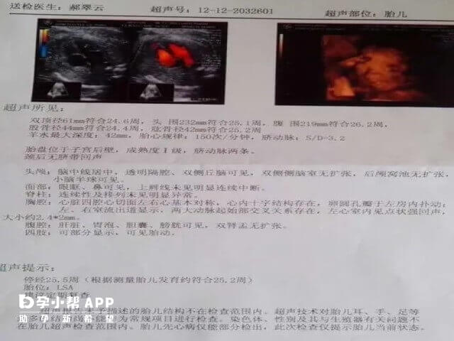 1-9月份羊水指数标准对照表