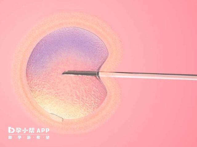 沈阳私立医院试管成功率