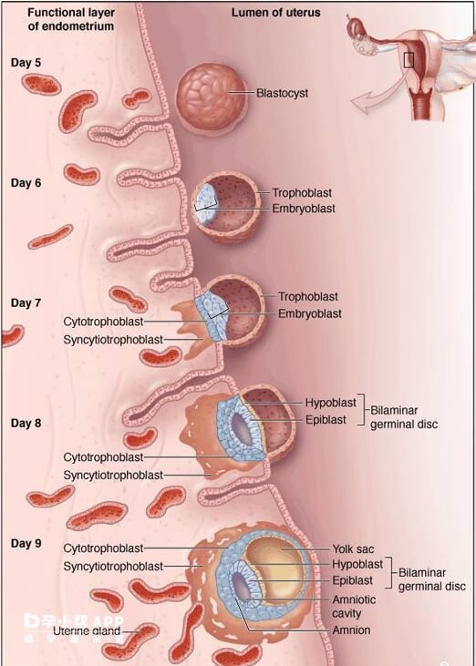 5天囊胚的着床过程图