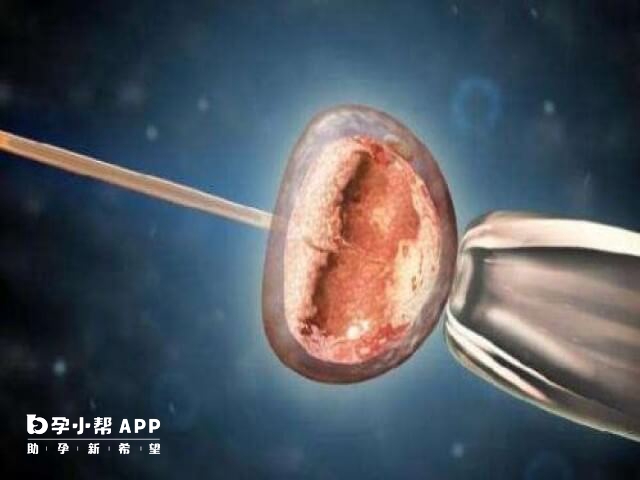 衡阳附二试管移植囊胚成功率在50%以上