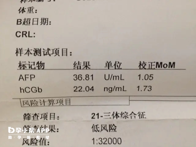 唐筛结果临界风险患唐氏儿的几率大