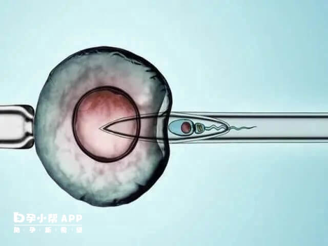 人授时卵巢内18-25mm卵泡3个成功率高