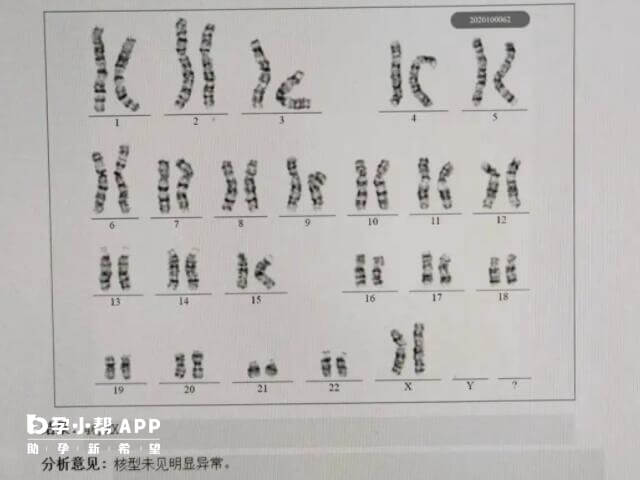 羊穿过了基因芯片核型没过考虑是物理元素