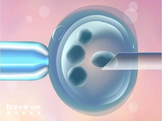 医生取卵经验和技术影响试管结果