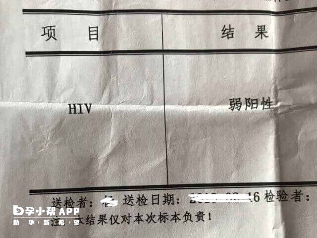 孕早期hiv“假阳性”不常见