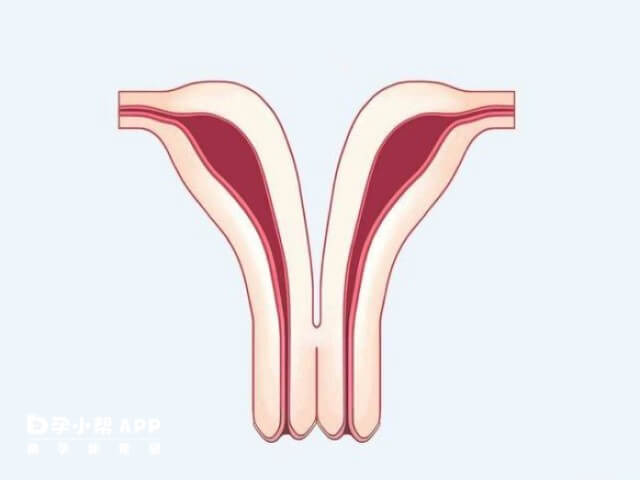 双子宫做试管一次怀孕成功率因人而异